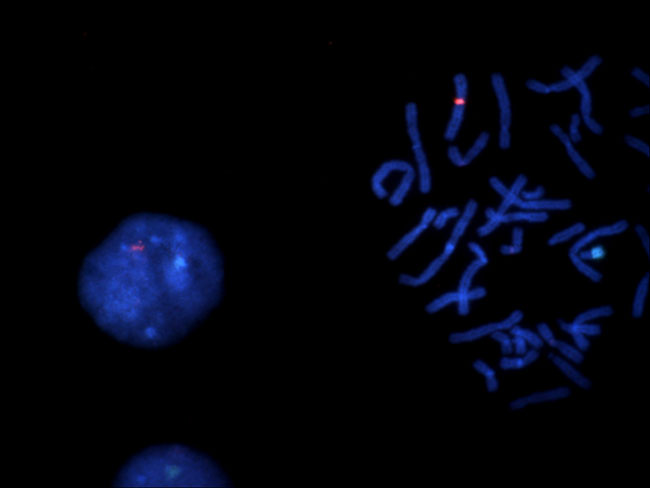 TCC-1.4hice染色體