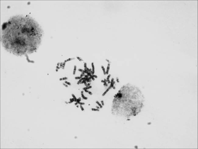 彩色轉(zhuǎn)黑白拍攝染色體