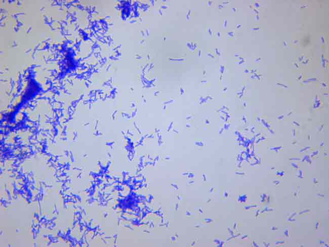 圖森TCC-3.3拍攝桿菌效果圖