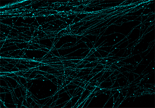 STORM超分辨成像