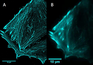 一種光熱療法抑制癌細胞轉(zhuǎn)移的研究